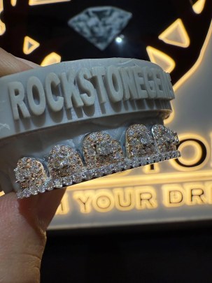 6 Upper Custom Diamond Grill