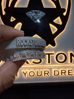 6 Upper Custom Diamond Grill 0