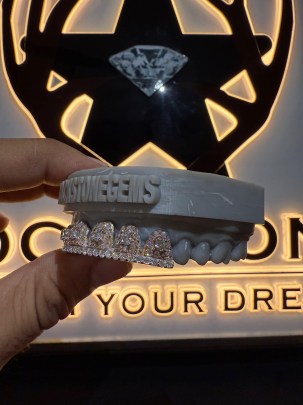 6 Upper Custom Diamond Grill 1